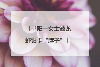 阜阳一女士被龙虾钳卡“脖子”